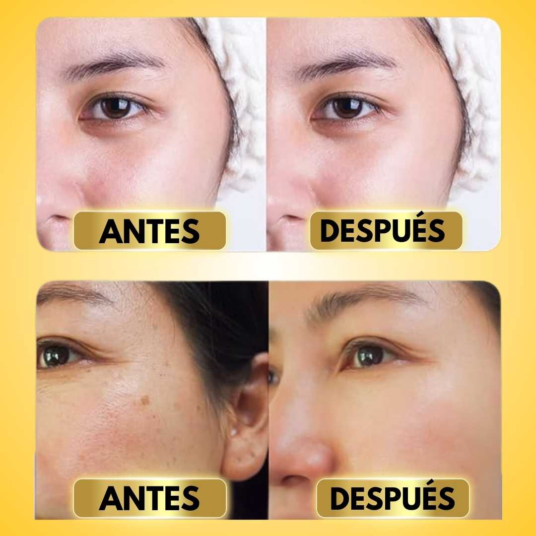 PACK DE 10 MASCARILLAS FACIALES CON EXTRACTOS DE ORO PARA SUAVIZAR ARRUGAS | FACE K24™