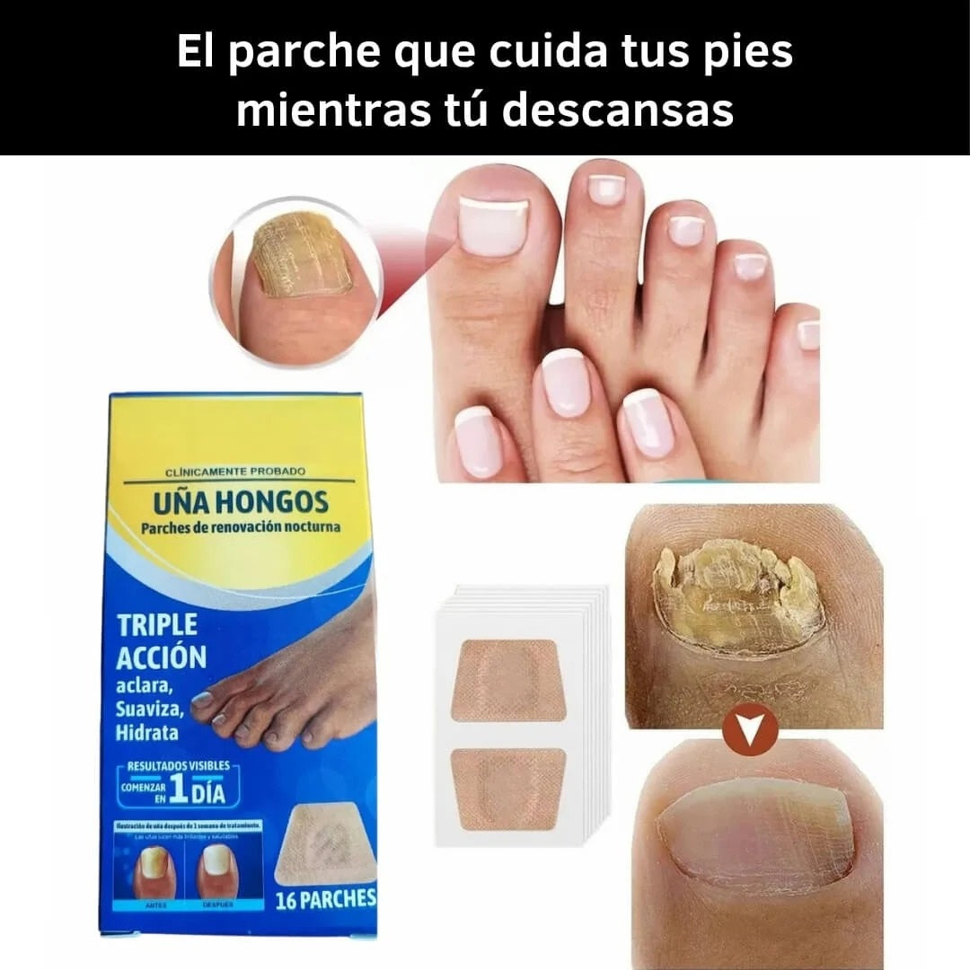 16 Parches Anti Hongos - Recupera y tus Uñas