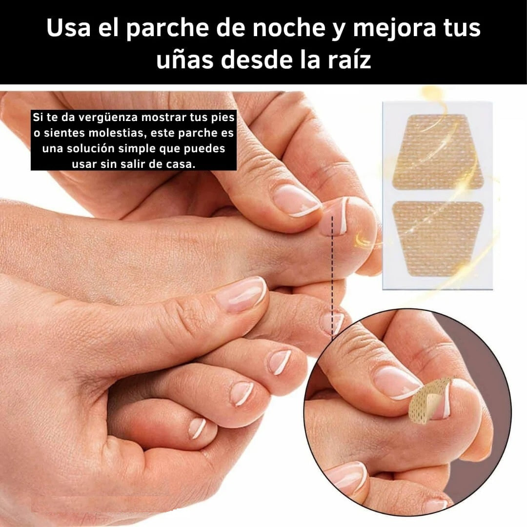 16 Parches Anti Hongos - Recupera y tus Uñas