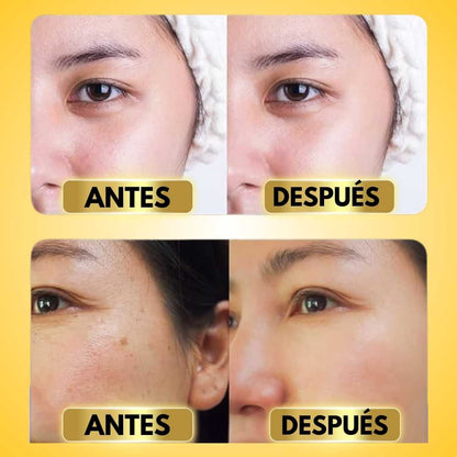 PACK DE 10 MASCARILLAS FACIALES CON EXTRACTOS DE ORO PARA SUAVIZAR ARRUGAS | FACE K24™