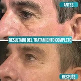 Serum Antiedad para Hombres